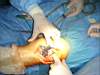 surgery_Knee_028.JPG