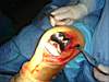 surgery_Knee_029.JPG