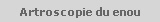 Artroscopie du enou 